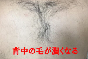 今まで生えてなかった所に毛が？！脱毛することで起こる身体の反応とは？